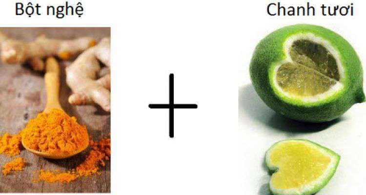 5 cách trị nám vô cùng hiệu quả đơn giản chỉ cần 1 củ nghệ