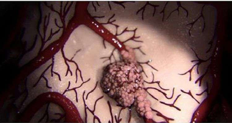 Cả thế giới ăn mừng nào: Tìm thấy hoạt chất khiến tế bào ung thư “tự sát” trong 30 phút